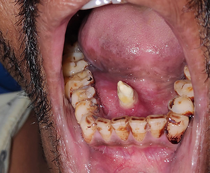orthodontics-case
