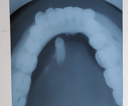 orthodontics-case